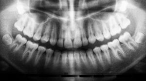 View original image source.